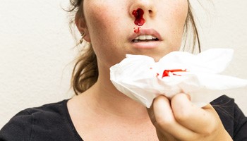 Nosebleed
