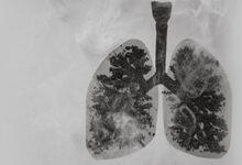 Lung Detox