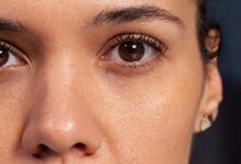 Dark Circles