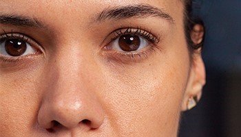 Dark Circles